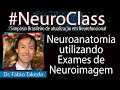 #NeuroClass: Neuroanatomia utilizando Exames de Neuroimagem - Dr. Fábio Takeda