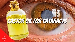 Castor Oil for Cataracts : Can YOU use it 