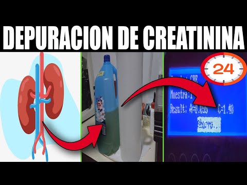 🫘¿Como hacer el