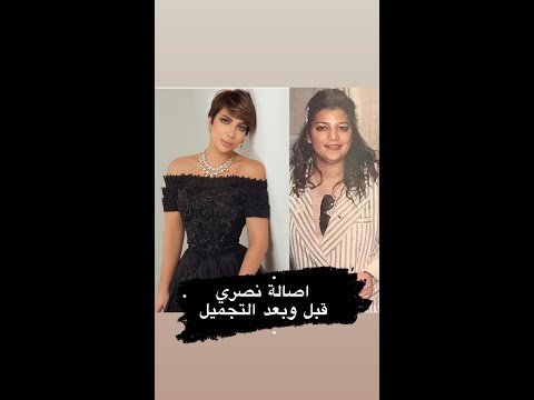 اصالة نصري بين الحاظر والماضي اصالة نصري قبل وبعد التجميل