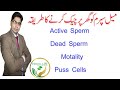 How To Check sperm at Home In Urdu By Herbalist | Best Treatment For Mot...
