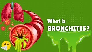 Bronchitis – Causes, Signs and Symptoms, Diagnosis & Treatment