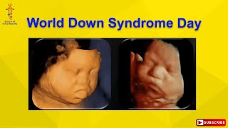 World Down Syndrome Day screenshot 3