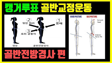 골반교정 스트레칭 없이 하는 방법: 골반교정운동 골반전방경사 체형교정 편