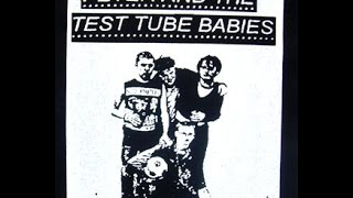 Watch Peter  The Test Tube Babies Keys To The City video