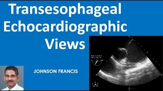 Transesophageal Echocardiographic Views