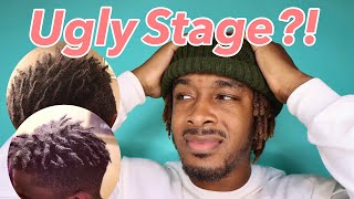 How to Deal With The Ugly Stage of Dreadlocks | 5 Ways to Improve Your Experience #dreadlockjourney