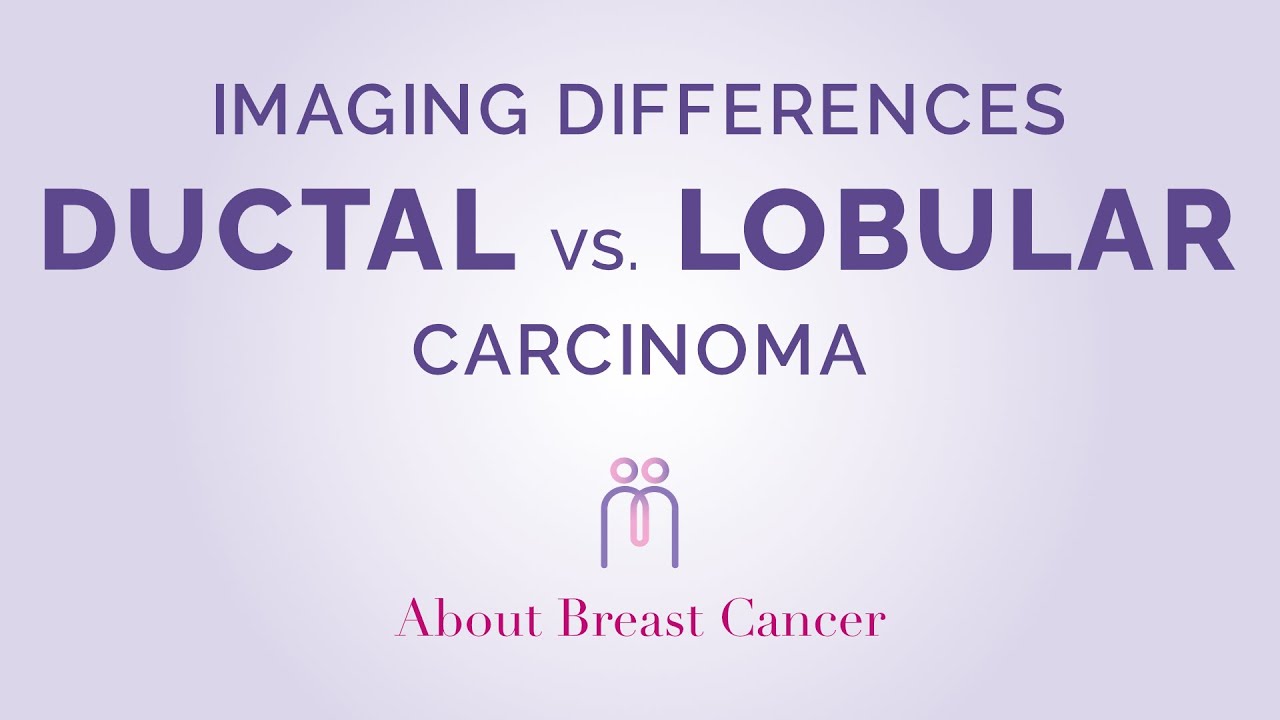 Imaging Differences Between Ductal And Lobular Carcinoma YouTube Imaging Differences Between Ductal And Lobular Carcinoma YouTube