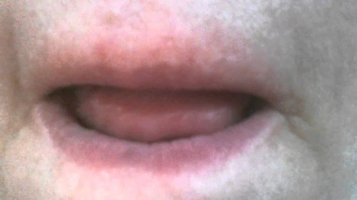 Can't find my teeth