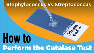 How to Perform the Catalase Test  Staphylococcus vs Streptococcus