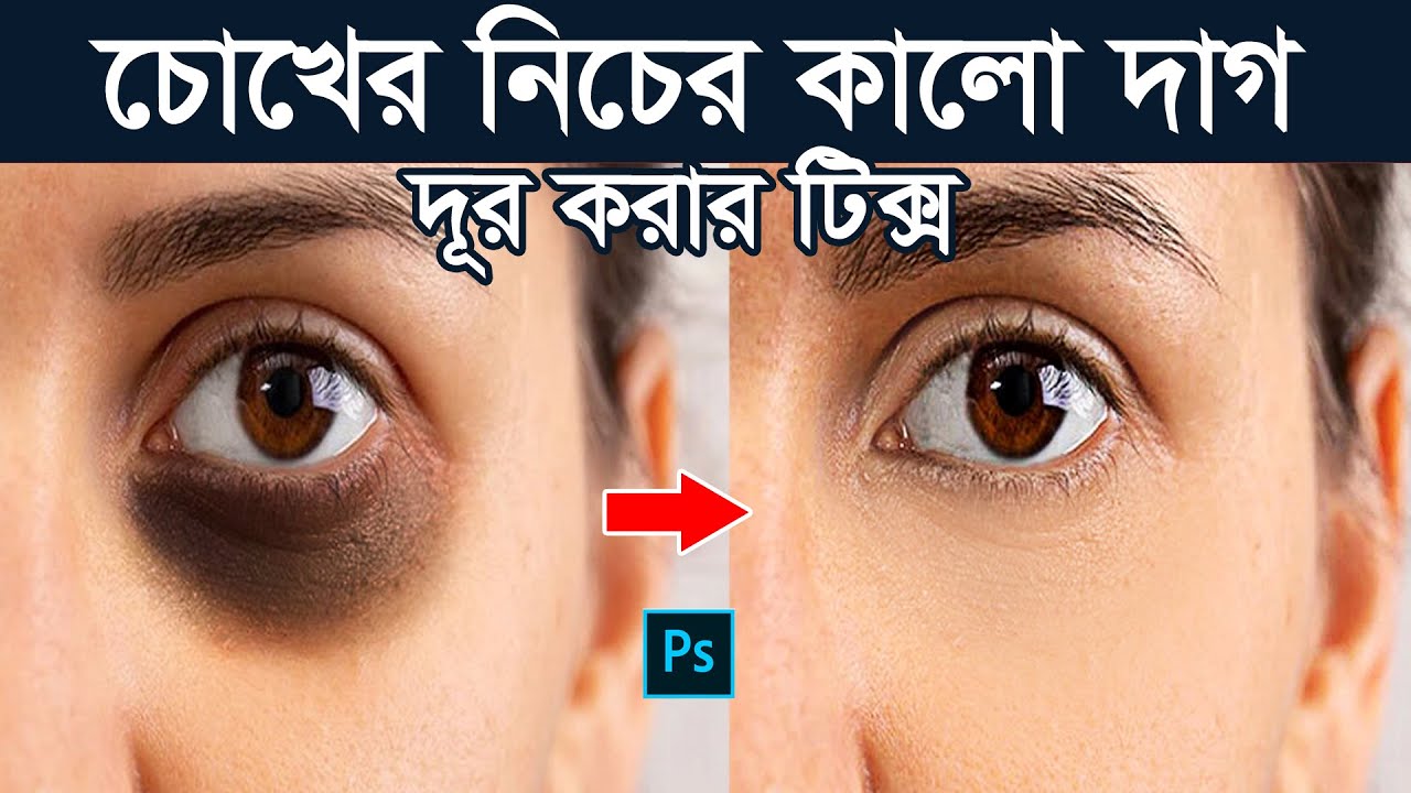 Remove Eye Dark Circles Naturally Using by Photoshop