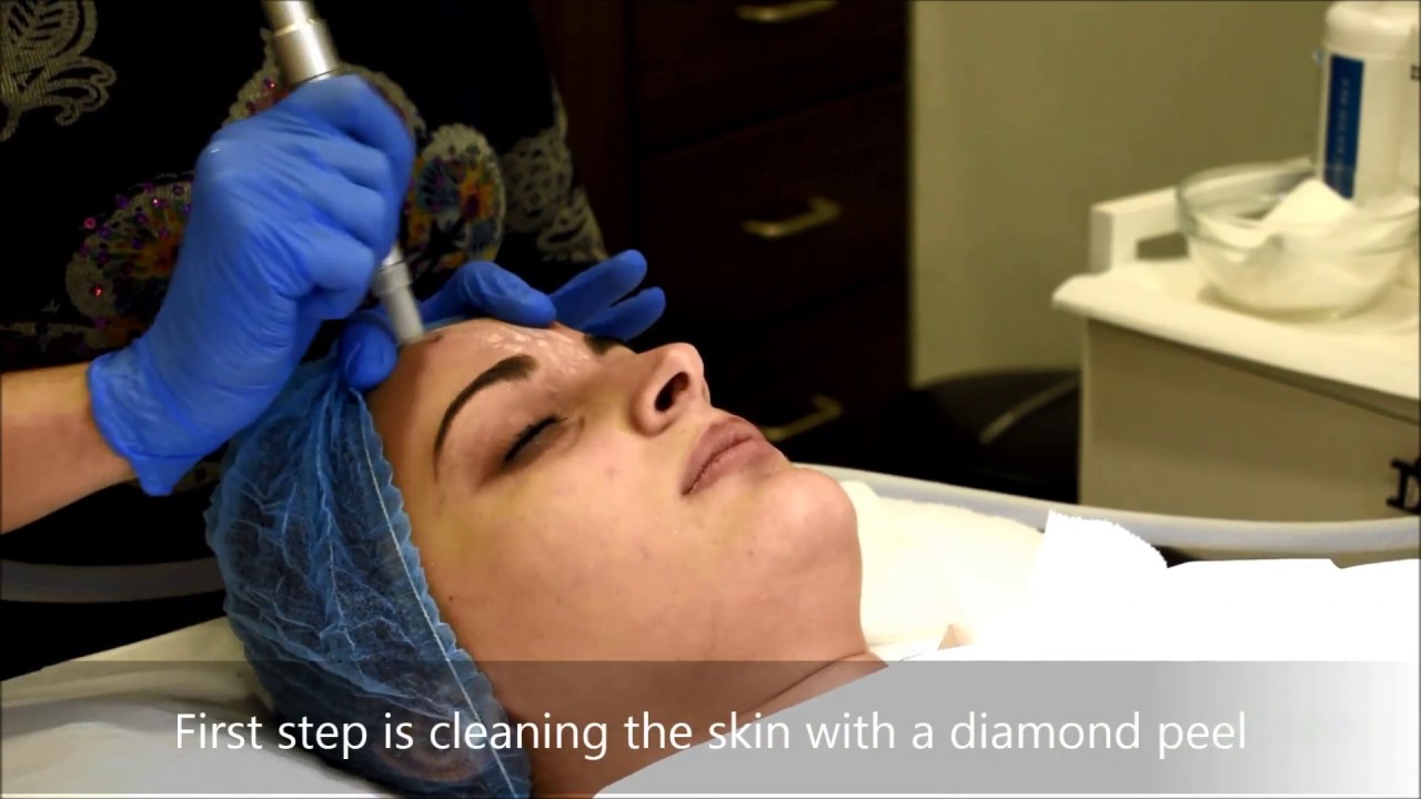 Microdermabrasion YouTube