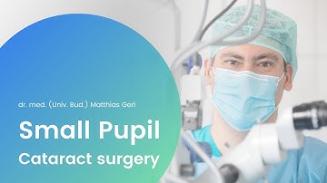 Small Pupil Cataract Surgery with LuxSmart™ EDOF Lens Implanation