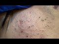 [ASMR] Facial Care and Pore Cleansing Therapy Session