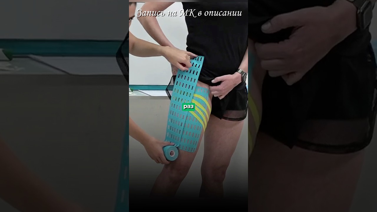 Кинезиотейпирование бедра с эстетической целью 