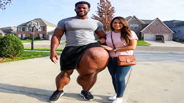 15 People With Bigger Than Normal Body Parts