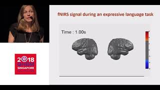 OHBM 2018 | Symposium | Anne Gallagher | Using NIRS-EEG as a clinical tool in children