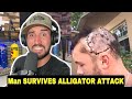 Diver Survives ALLIGATOR Attack on HEAD And Tells the HORRIBLE Story!! *BANGER PODCAST*