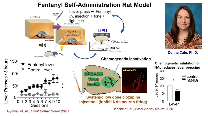 Linda Chang: Focused Ultrasound for Neuromodulatio...