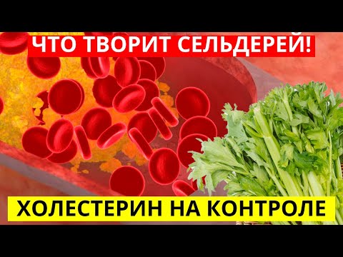 И Что Будет, Если Кушать Сельдерей Каждый День В Течение 3 Дня!