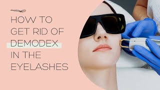 #109: How to Get Rid of Demodex in the Eyelashes