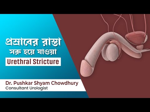 ইউরেথ্রাল স্ট্রিকচার এর কারণ ও চিকিৎসা |  Urethral Stricture Symptoms and Treatment in Bengali