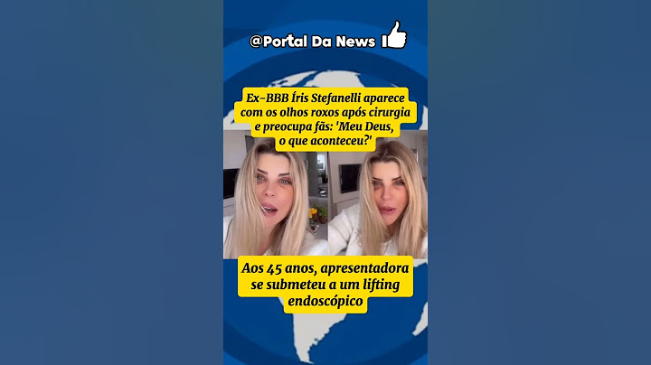 Ex-BBB Íris Stefanelli aparece com os olhos roxos após cirurgia e preocupa fãs