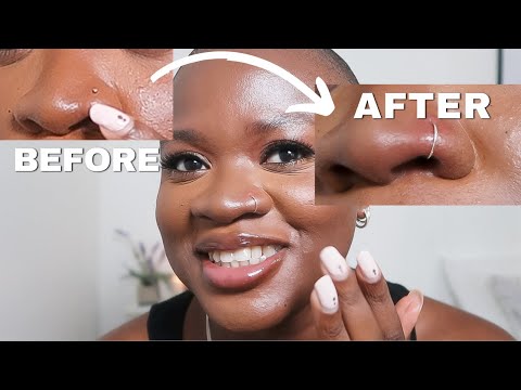 Video: Kaip pakeisti nosies žiedą?