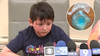 Burn victim urges kids to not follow 'Needoh Cube microwave trend' on TikTok Information