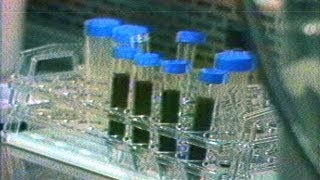 April 23, 1984: AIDS Discovered - www.NBCUniversalArchives.com