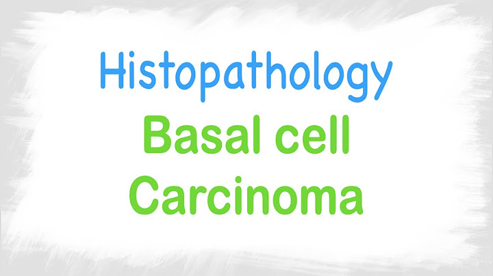 Squamous cell carcinoma vs basal cell carcinoma histology