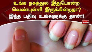 உங்க நகத்துல இதுபோன்ற வெண்புள்ளி இருக்கின்றதாஇந்த பதிவு உங்களுக்கு தான்!! | Nail | Sathiyam TV News screenshot 2