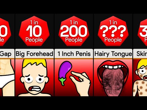 Comparison: Do You
