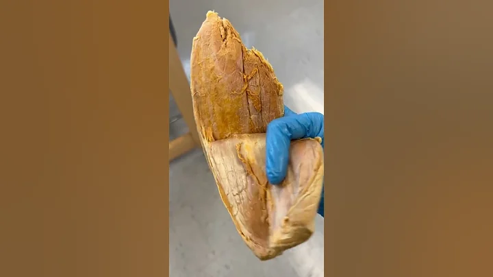 Real Human Achilles Tendon