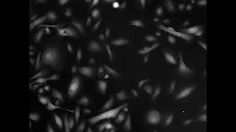 Cellular Heaven and Hell - ASCB Runner Up!