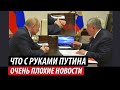 Что с руками Путина. Очень плохие новости