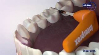 Dentaid New Interprox French