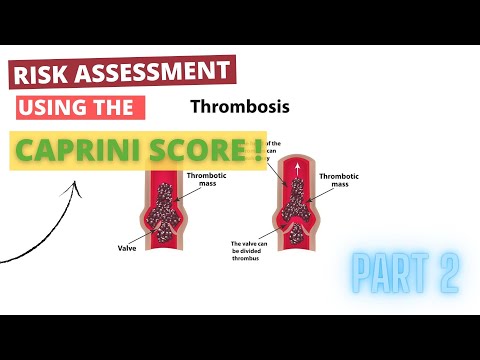Risk Assessment using