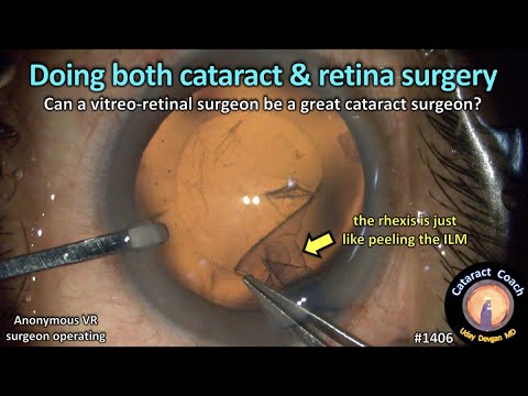 Videó: Végeznek szürkehályog-műtétet a retina specialisták?