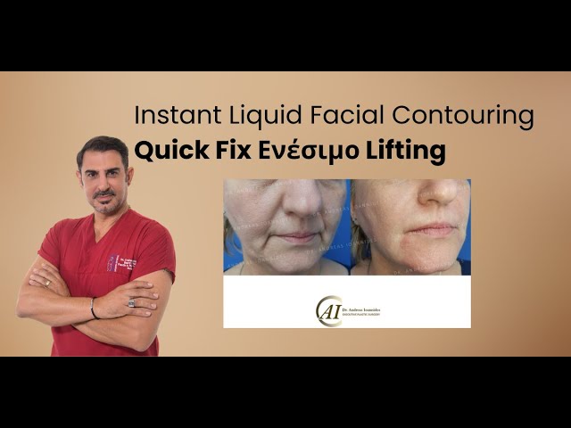 Μη επεμβατικό λίφτινγκ - Liquid Facial Contouring #liquidrhinoplasty #liquidfacelift  #fillers