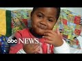 8-Year-Old Boy Receives Dual Hand Transplants