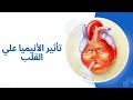 تأثير الانيميا علي القلب 