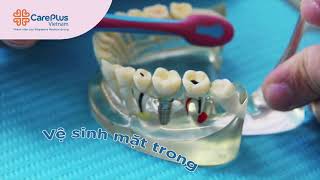 Đánh răng đúng cách và 4 sai lầm mắc phải mỗi ngày – Up Dental