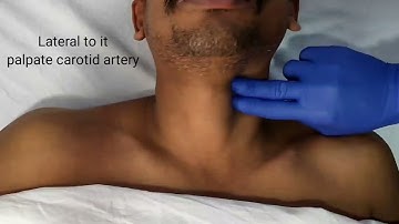 How to do Carotid Sinus Massage