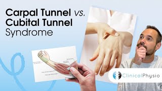 Carpal Tunnel Syndrome vs. Cubital Tunnel Syndrome | Expert Physio Guide