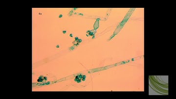 ORGANISM SLIDE: Vaucheria