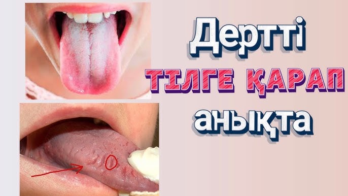 Адекватсыз əйелдер жынды