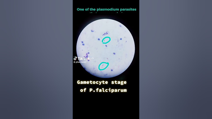 Plasmodium Falciparum under Microscope 🔬  #shorts #malaria #parasite
