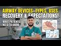 Airway Devices