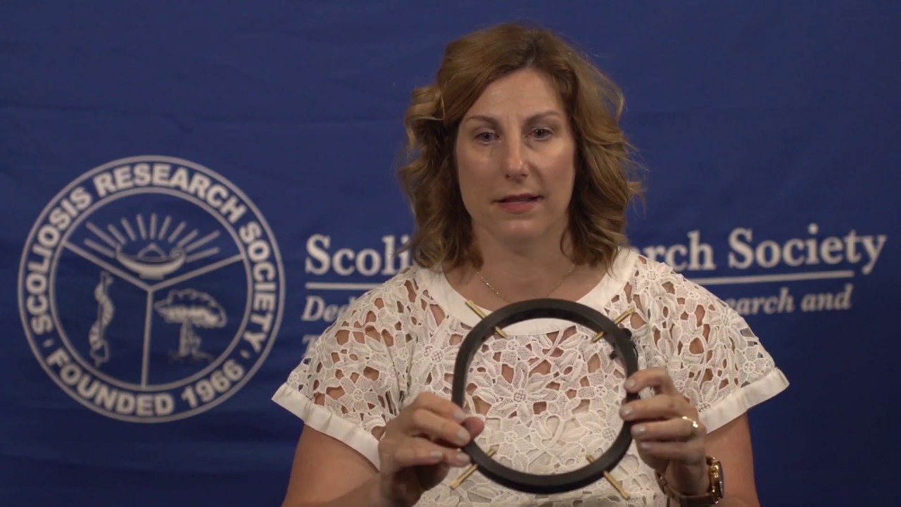 SRS Patient Video Halo Gravity Traction Amy McIntosh, MD YouTube